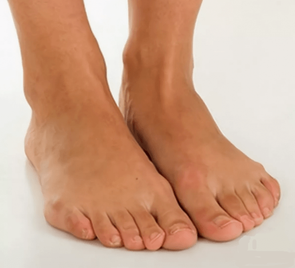 Veselīgas kājas pēc ārstēšanas ar Hondrox aerosolu