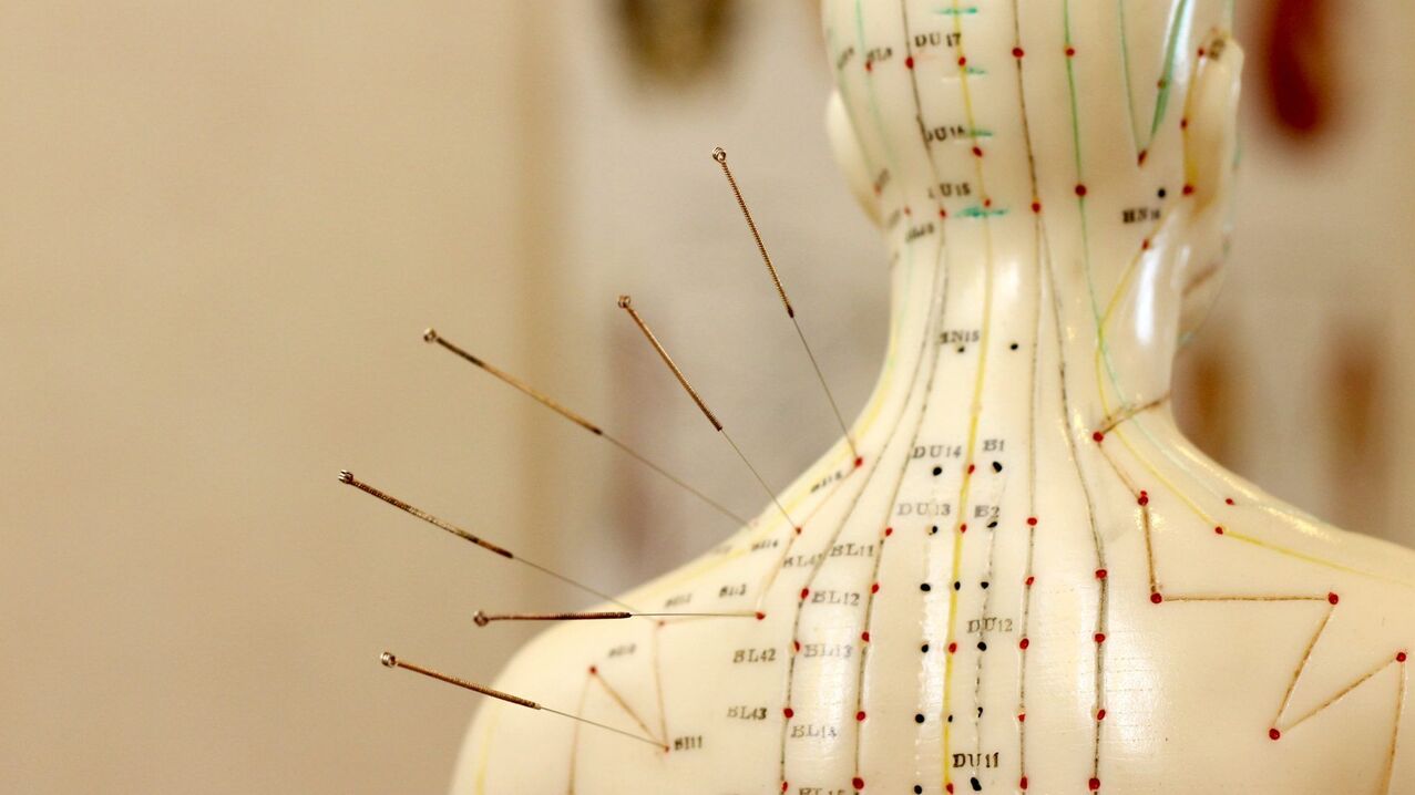 akupunktūra dzemdes kakla osteohondrozes ārstēšanai