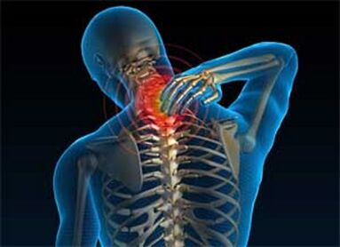 Sāpes kaklā ir izplatīts osteohondrozes simptoms