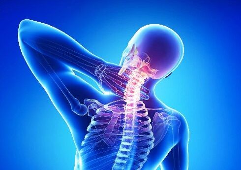 dzemdes kakla osteohondroze